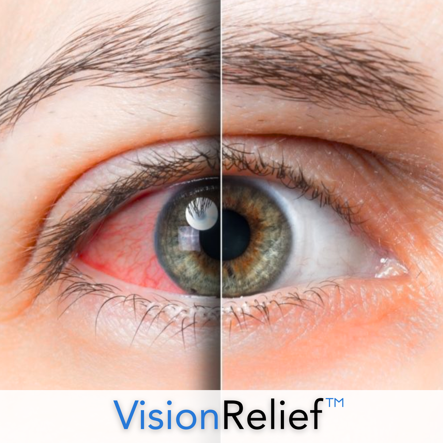 VisionRelief Device™